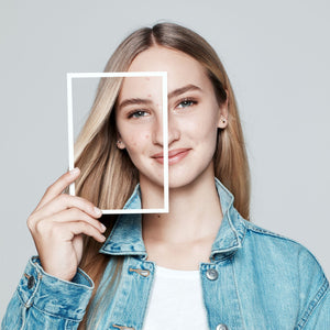 Skincare per pelle grassa e imperfezioni: quali ingredienti cercare nei propri prodotti?