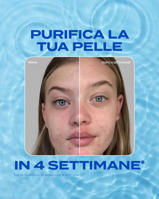 Routine Anti-Imperfezioni – 3 Step per Pelle Impura