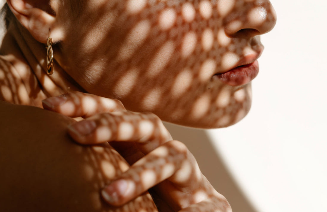 Macchie solari, melasma e iperpigmentazione: cosa sono e come trattarle