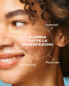 Brufoli e punti neri: come migliorare l’aspetto della pelle con la giusta routine